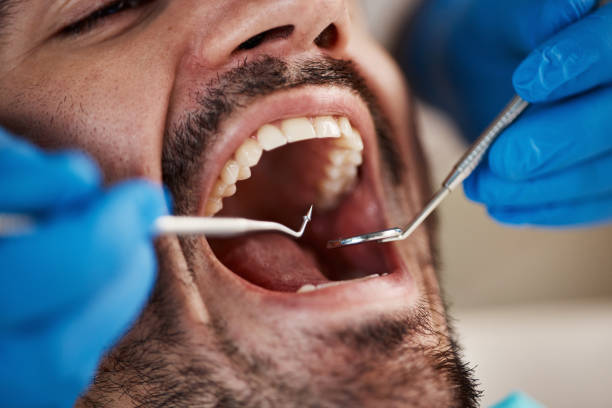 Best Emergency Dental Filling Replacement  in Lake Ridge, VA